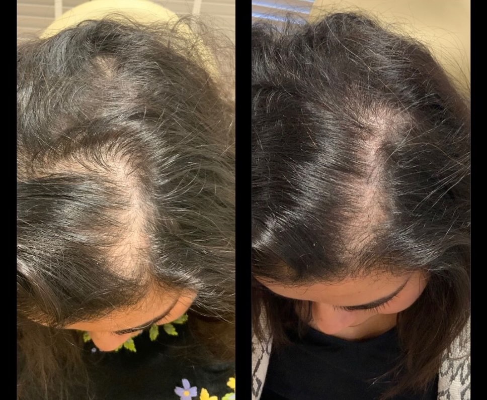 Customer result 1