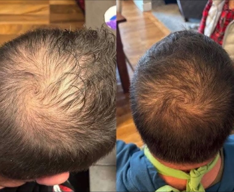 Customer result 3