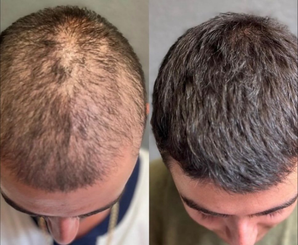 Customer result 4