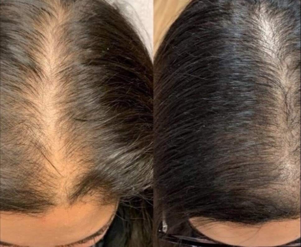 Customer result 5