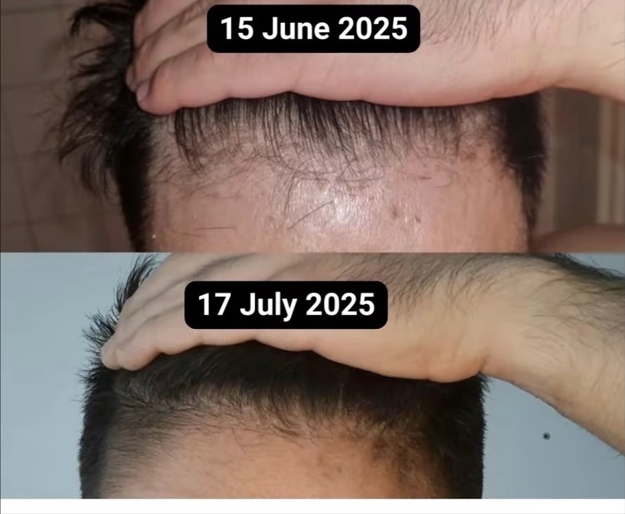 Customer result 6